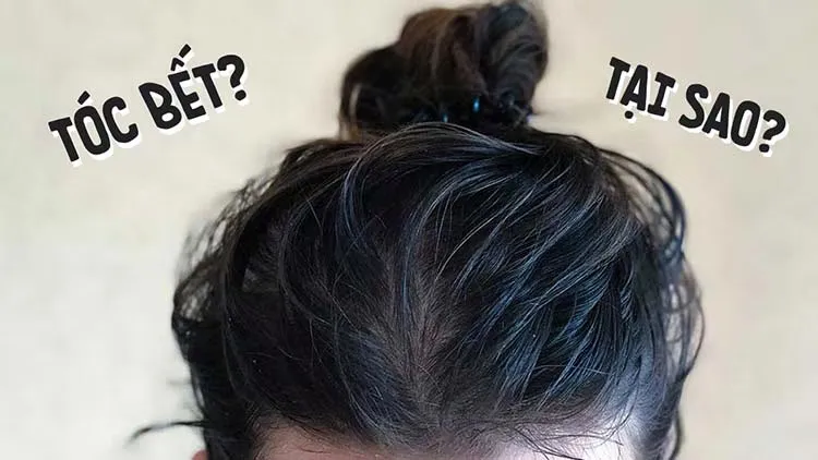 Tóc dầu và bết dính